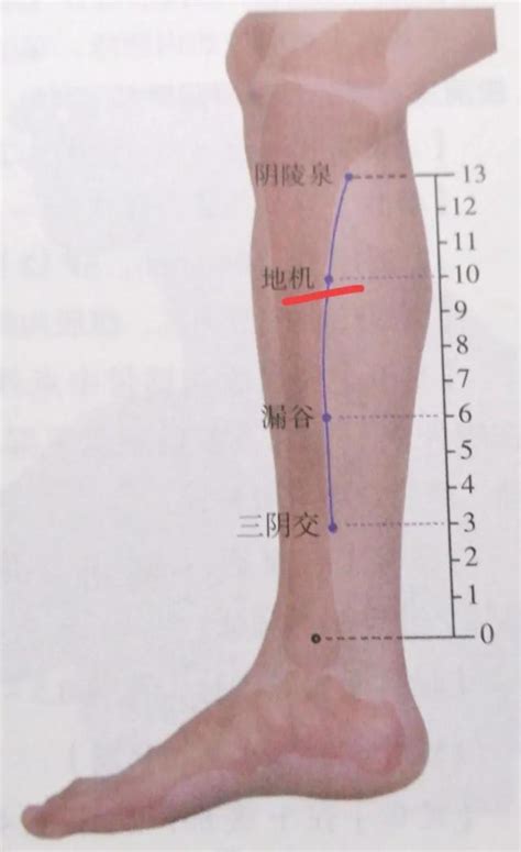 地機穴氣結|地機穴(地機):名稱釋義,功能作用,治法,定位,解剖,主治,操作,臨床運。